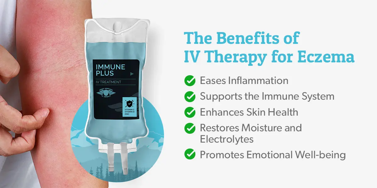 can glutathione cure eczema Sooth Eczema with IV Therapy: Exploring the Benefits